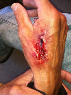 SFX: Knife Wound