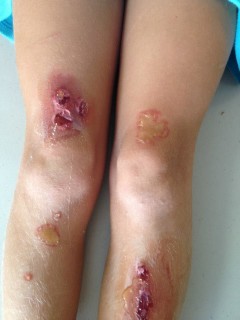 SFX